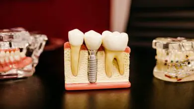évolution des soins orthodontiques