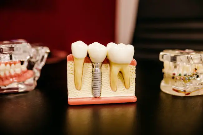 évolution des soins orthodontiques